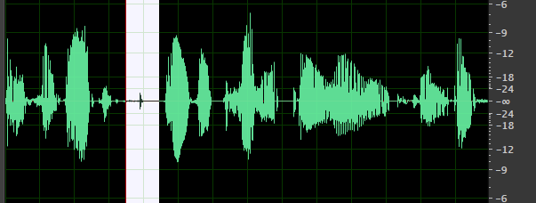 Dialogue Waveform Raw with No Edits but with Mouth Clicks