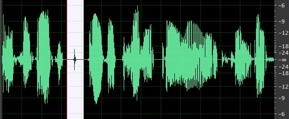 Dialogue Waveform Compressed & Normalised with Mouth Clicks